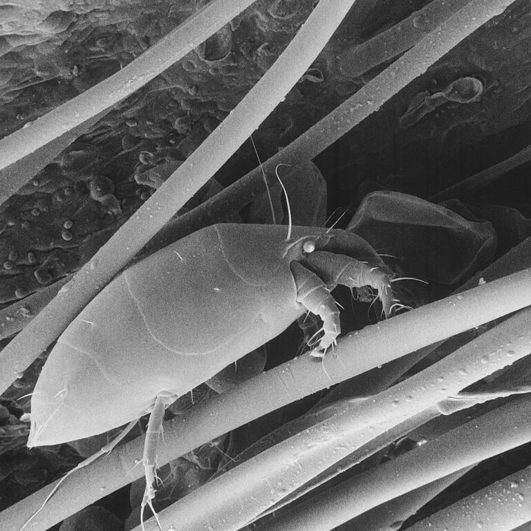 Microscopic image of the Strawberry mite Phytonemus pallidus